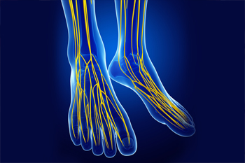 morton's neuroma 