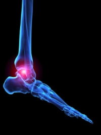 Symptoms of Rheumatoid Arthritis