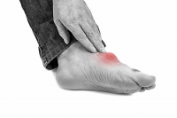 What Triggers Gout?
